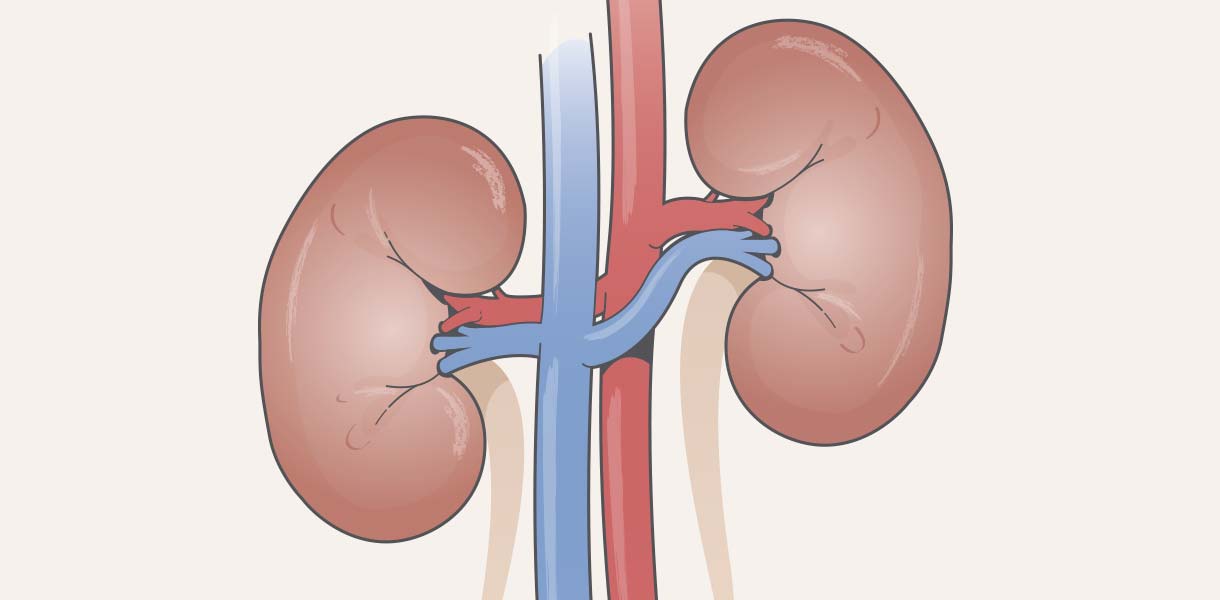 Prevención Renal